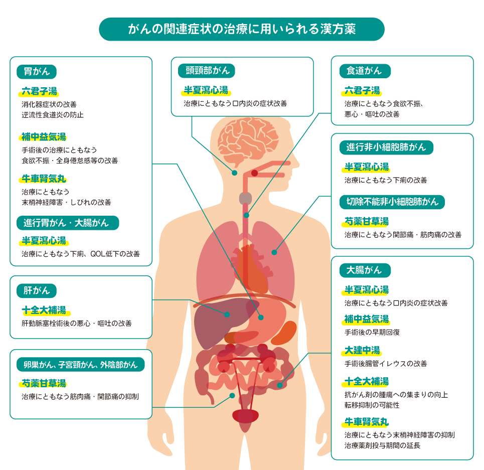 がんの関連症状の治療に用いられる漢方薬